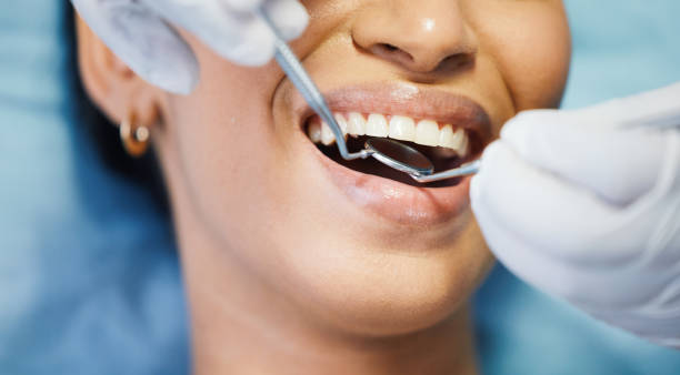 Dentist for Dental Trauma in MD